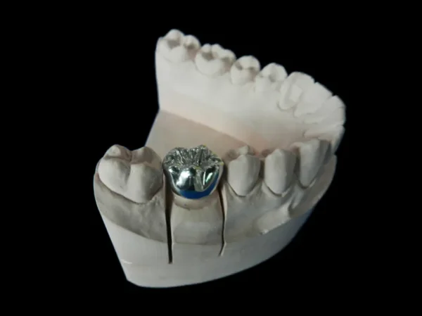 Full Cast Semi-precious crowns