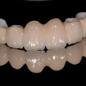High Translucent Zirconia