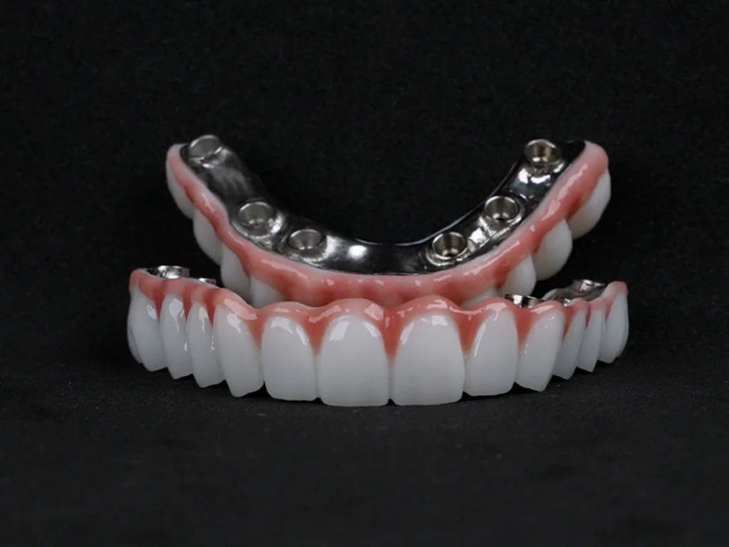 Titanium Hybrid Dentures