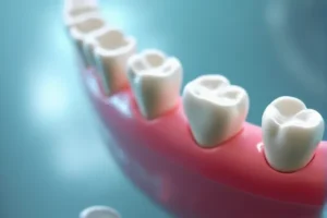 semi-precious-alloys-perform-in-terms-of-strength-and-biocompatibility