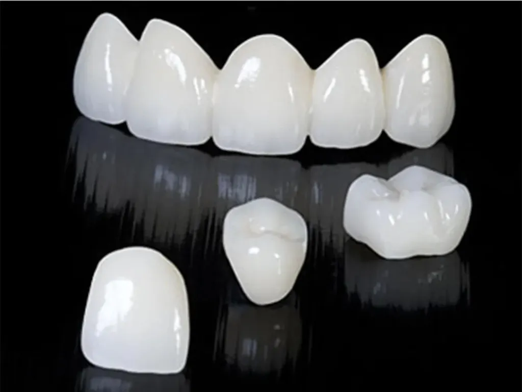 All Ceramic Crown & Bridge
