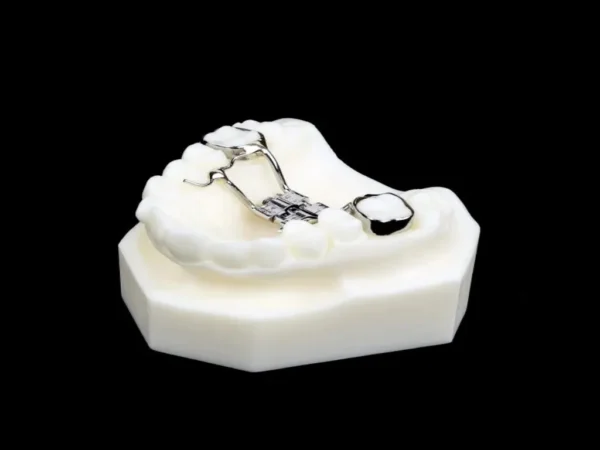 Bonded Palatal Expande