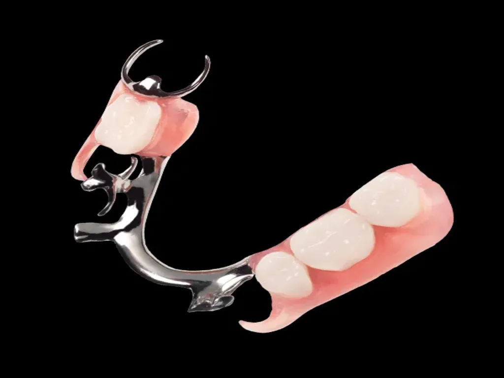 Chrome Cobalt Dentures