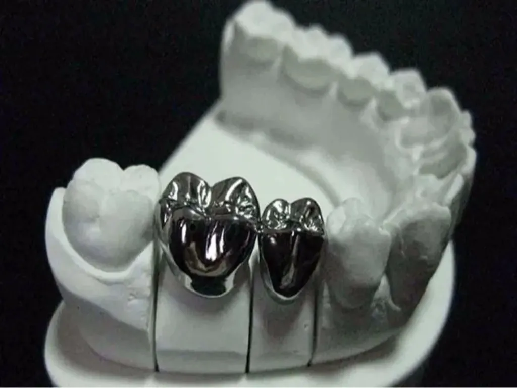 Full Cast Crown & Bridge