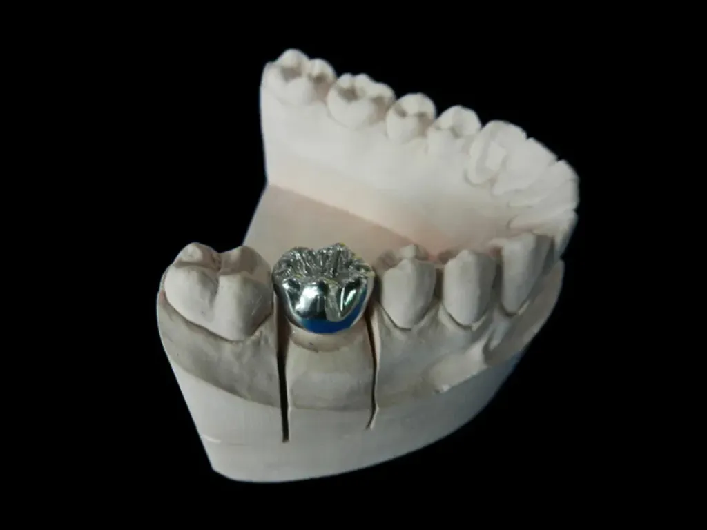 Full Cast Semi-precious crowns