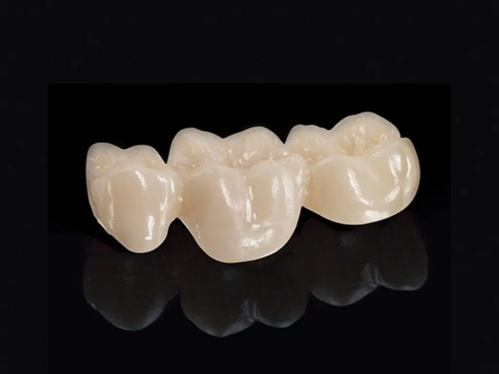 IPS e.max