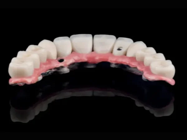 Snap-In Dentures