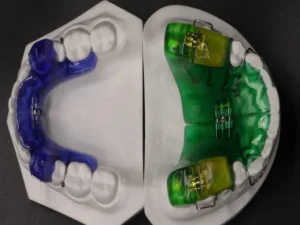 Twin Block Appliance - 