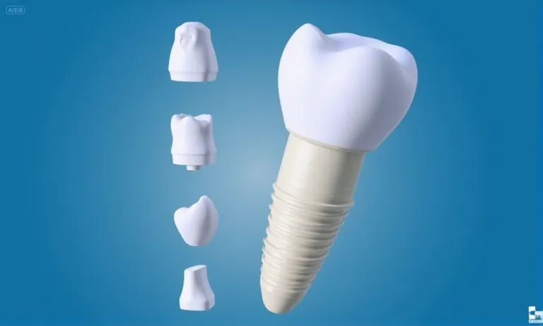 How 3D Printing Improves Efficiency and Lowers Costs in Dental Implant Lab Workflows