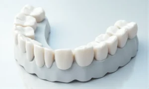 What Are the Key Differences Between Zirconia and PFM for Full-Arch Implant Restorations