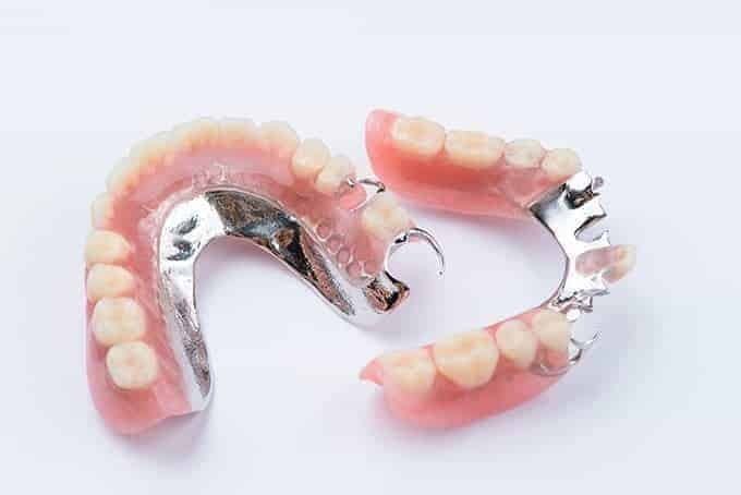 Cast Metal Partial Denture