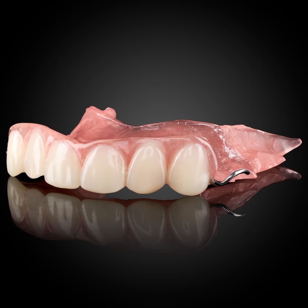 Acrylic Partial Denture