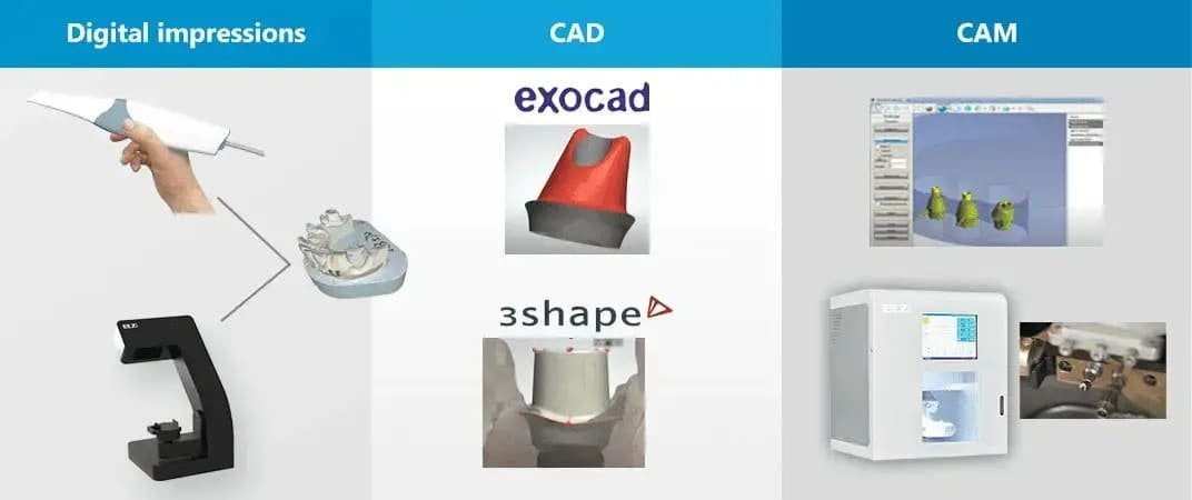Dental Digital Workflow 2
