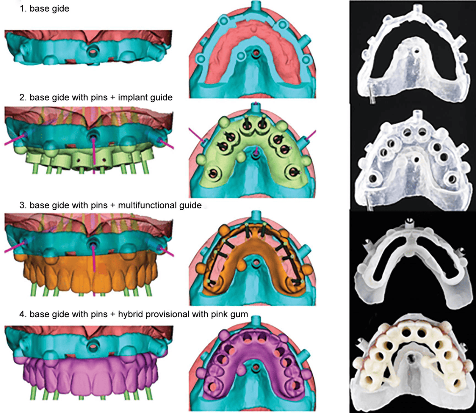 Raytops Surgical Guide Planning + Design 6