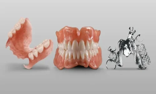 Removable dental